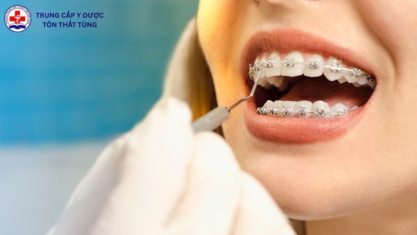 cao đẳng điều dưỡng nha khoa