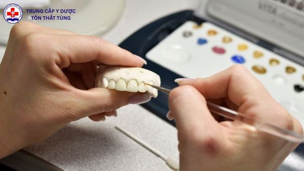 kỹ thuật phục hình răng là gì