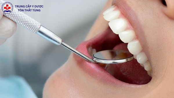 kỹ thuật phục hình răng làm gì