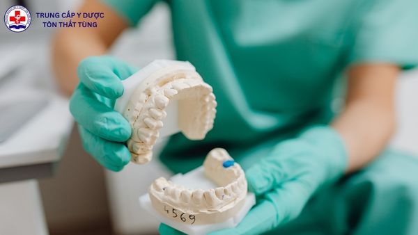 kỹ thuật phục hình răng làm gì