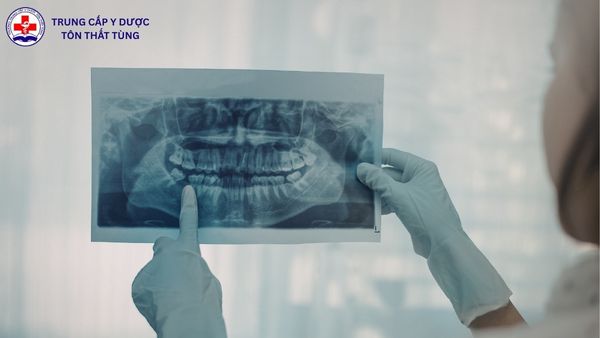 kỹ thuật phục hình răng làm gì