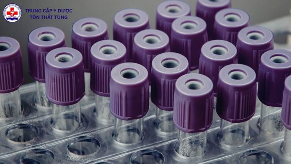 mức lương của ngành xét nghiệm y học