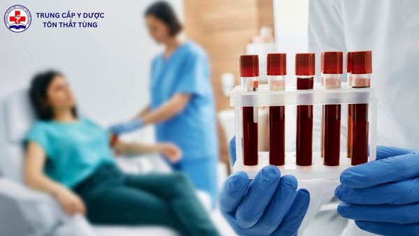 Mức lương của ngành xét nghiệm y học hiện nay là bao nhiêu? mức lương của ngành xét nghiệm y học