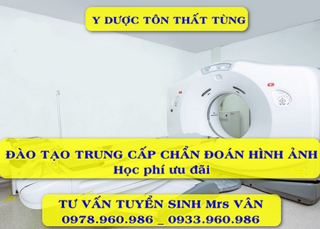 Học trung cấp chẩn đoán hình ảnh y học có dễ xin việc không?